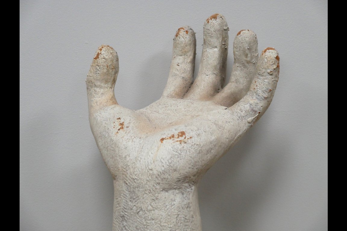 Arm