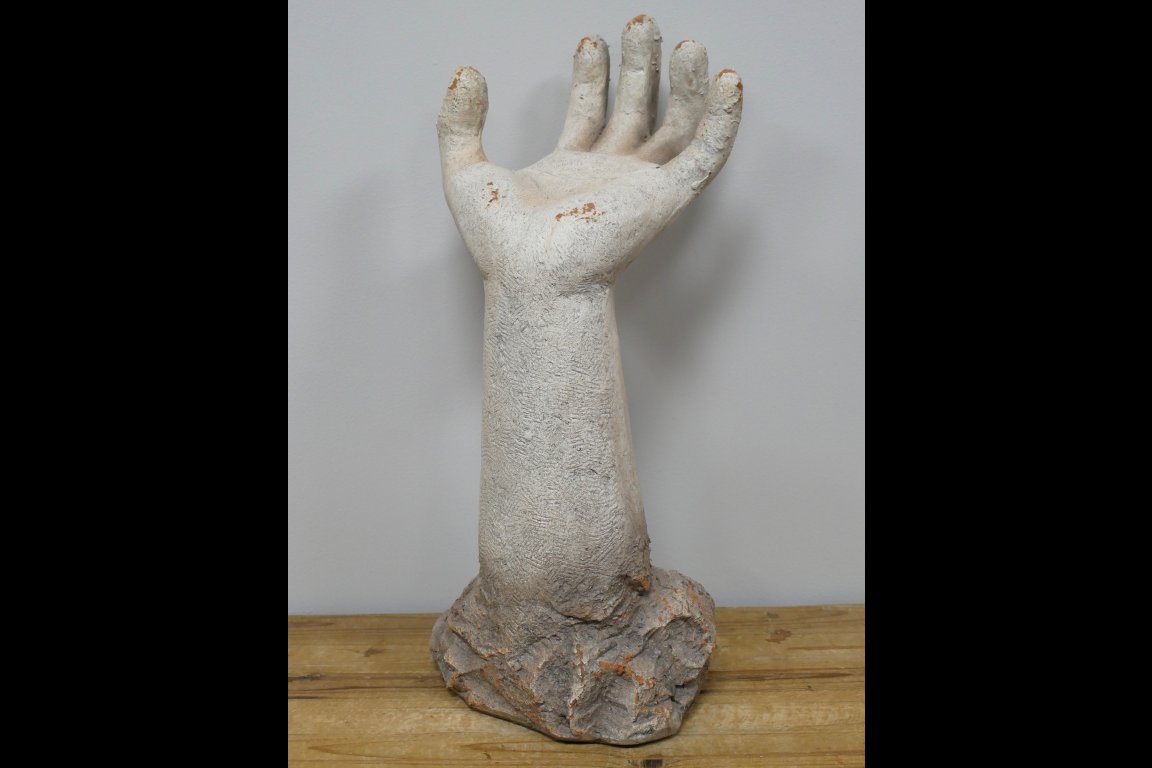 Arm