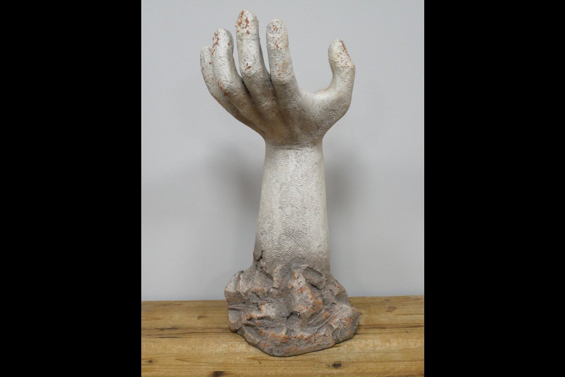 Arm